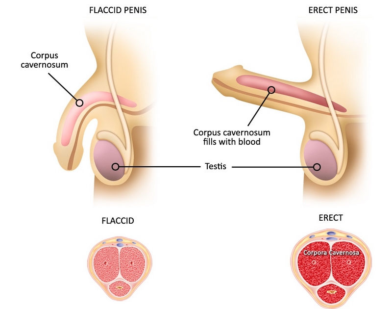 Erection Mechanism