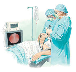 bronchoscopy