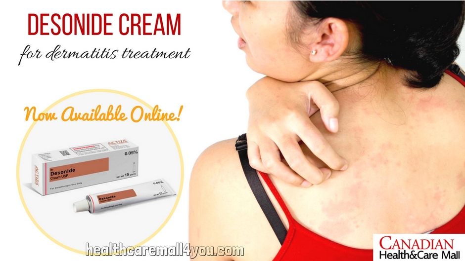 Desonide Cream